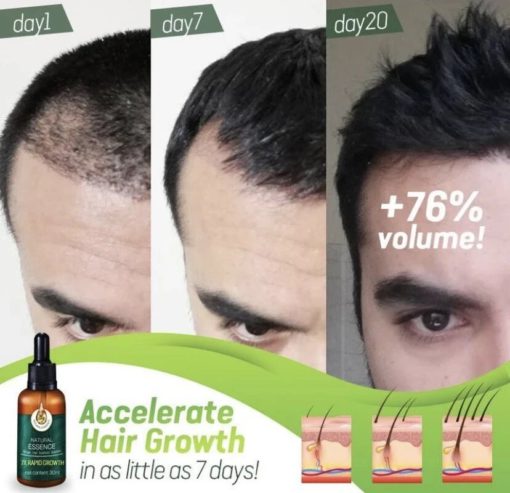 7X Rapid Growth Hair Treatment