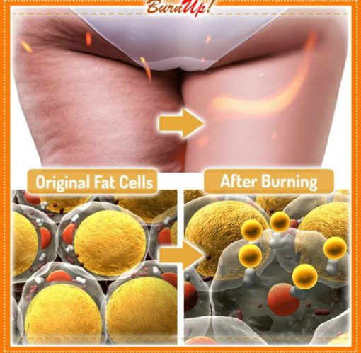 BurnUp! Ultimate Cellulite Heating Spray