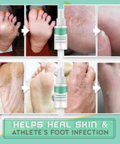 Fresh Foot Deodorant Antifungal Spray