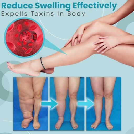 Anti Varicose And Swelling Magnetotherapy Anklet