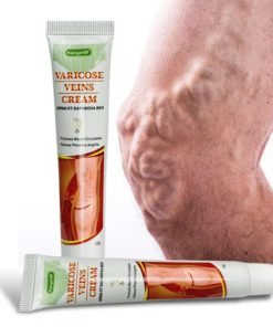 Varicose Veins Miracle Cream