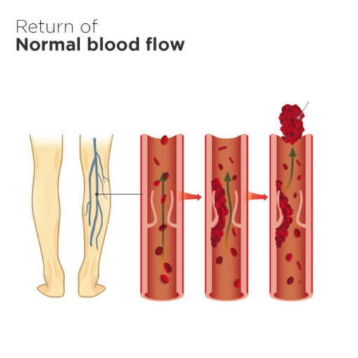 Vein Care Fading Cream