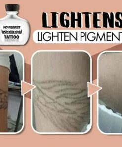 No Regret Tattoo Removal Oil