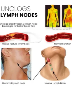 LymphaticPro™ Lymph Nodes Herbal Detox Cream