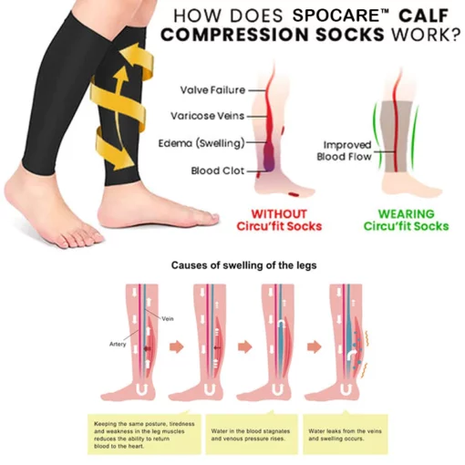 SPOCARE™ Thermally Cycling Self-Shaping Compression Socks - Image 2