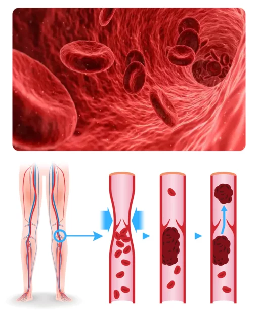 PureHealth™️ Lymphatic Detoxing Ginger Foot Soak - Image 7