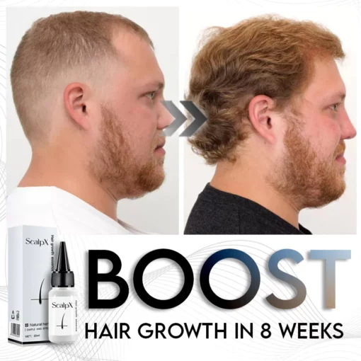 ScalpX Hair Growth Essence - Image 2