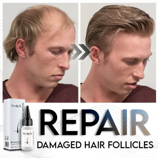 ScalpX Hair Growth Essence - Image 3