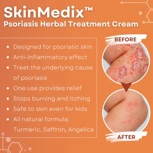 SkinMedix™ Psoriasis Herbal Treatment Cream - Image 5