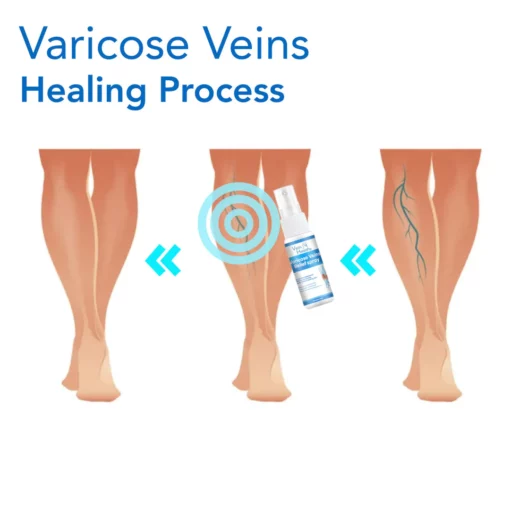 VeinHealthy Varicose Veins Spray - Image 3