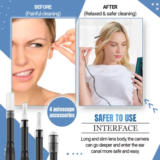 3-in-1 Smart Visual Ear Cleaner - Image 4