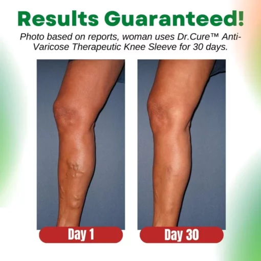 Dr.Cure™ Anti-Varicose Therapeutic Knee Sleeve - Image 5