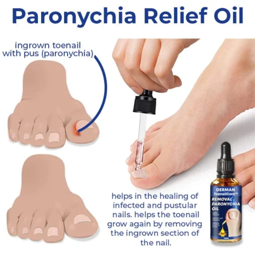 German ToenailCare™ Removal Paronychia Oil - Image 2