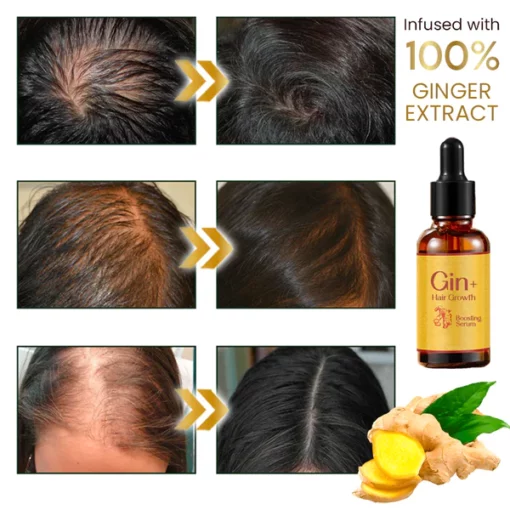 Gin+ Hair Growth Boosting Serum - Image 3