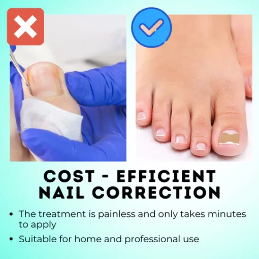 HealPatch™ Ingrown Toenail Corrector - Image 3