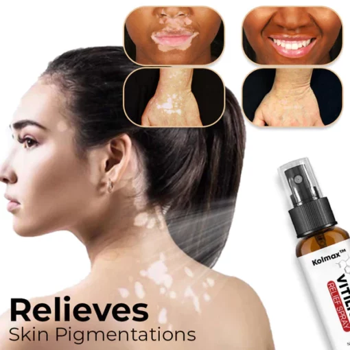 Kolmax™ Vitiligo Relief Spray - Image 2