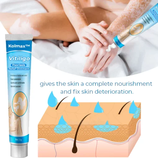 Kolmax™ Vitiligo Soothing Ointment - Image 4