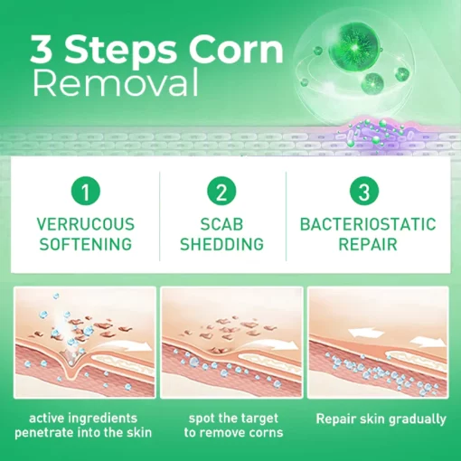 MEDix™ Active Corn Remover - Image 5