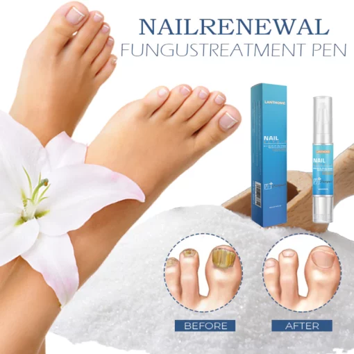 NailRenewal FungusTreatment Pen - Image 2