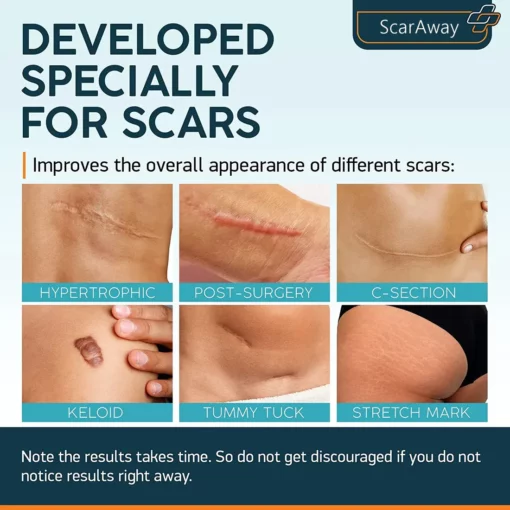 ScarAway Advanced Scar Gel - Image 2