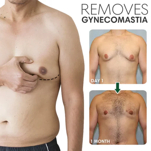 SoliPac™ Gynecomastia Tightening Ginger Cream - Image 3