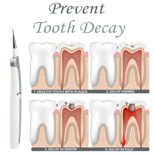 TeethWhitener Ultrasonic Vibration Cleaner - Image 5