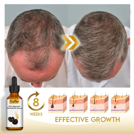 Truffer Hair Regrowth Ganoderma Serum - Image 3