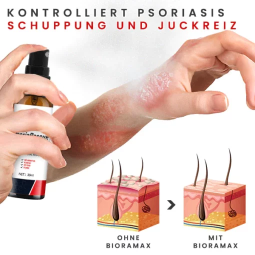 BIORAMAX PsoriaRescue Behandlung Spray - Image 2