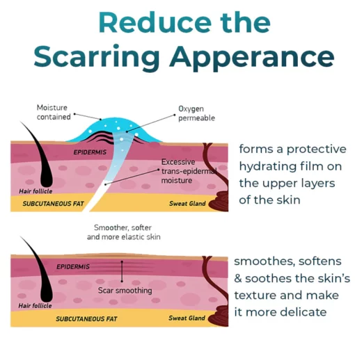 Bioskin™ Advanced Scar Removal Gel - Image 5