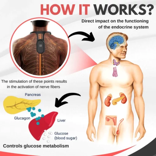 Mericle™ Sugar Control Acupressure Neck Device - Image 4