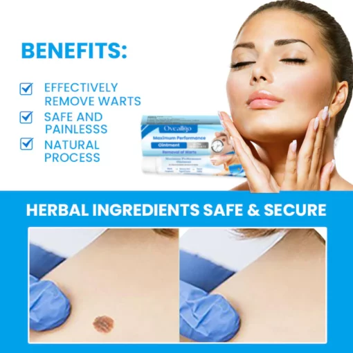 Oveallgo™ Maximum Performance Ointment for the Immediate removal of Warts - Image 3