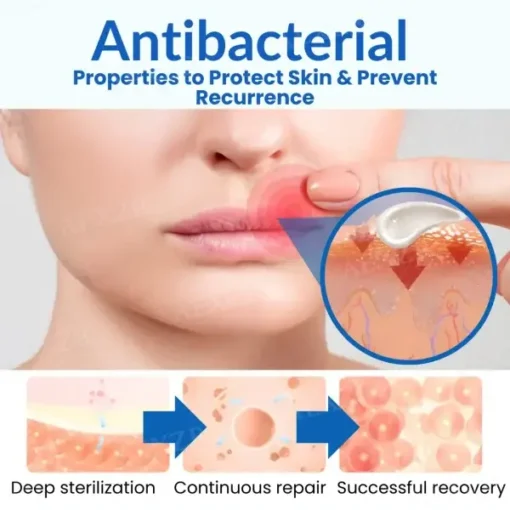 AEXZR™ Cheilitis Antibacterial Treatment Cream - Image 4