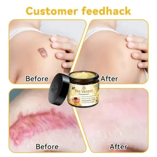 Alivina™ Bee Venom Treatment Cream - Image 5