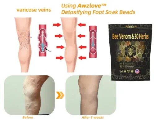 Awzlove™ Bee Venom & 30-Herb Detox Foot Soak Beads for Body Sculpting - Image 10