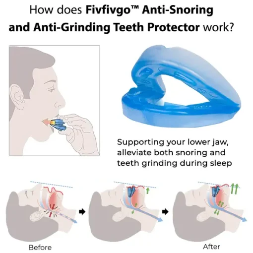 Fivfivgo™ Anti-Snoring and Anti-Grinding Teeth Protector - Image 2