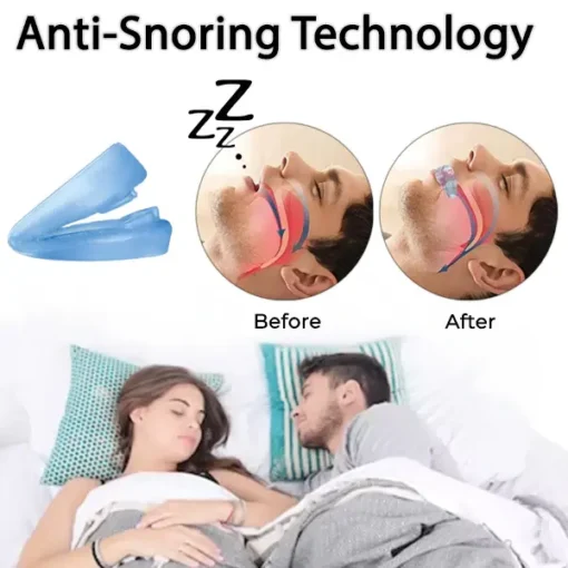 Fivfivgo™ Anti-Snoring and Anti-Grinding Teeth Protector - Image 3