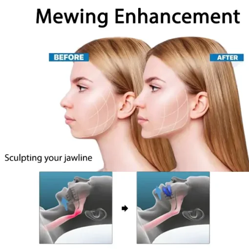 Fivfivgo™ Anti-Snoring and Anti-Grinding Teeth Protector - Image 5