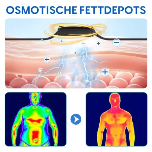 GFOUK™ Ultraschall-Fettverbrennungs- und Entgiftungsarmband - Image 8