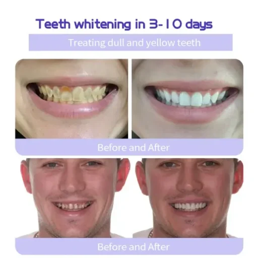 GarageLine™ Dental Mineral Powder - Image 4