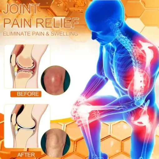 Jorondy™ Bee-Venom Pain-Relief Bone Healing Cream - Image 6