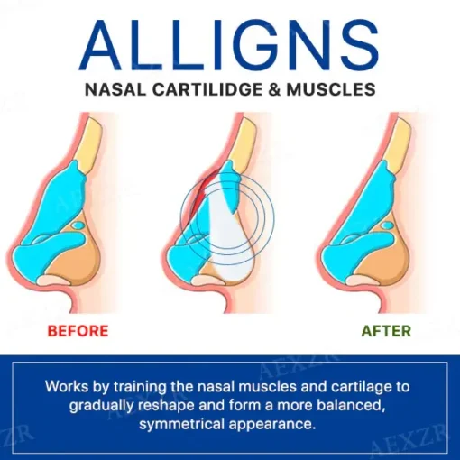 Nostafix™ Nose Corrector Device - Image 3