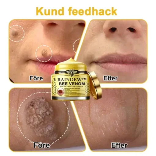 Raindew™ Bee Venom Skin Treatment Cream - Image 5