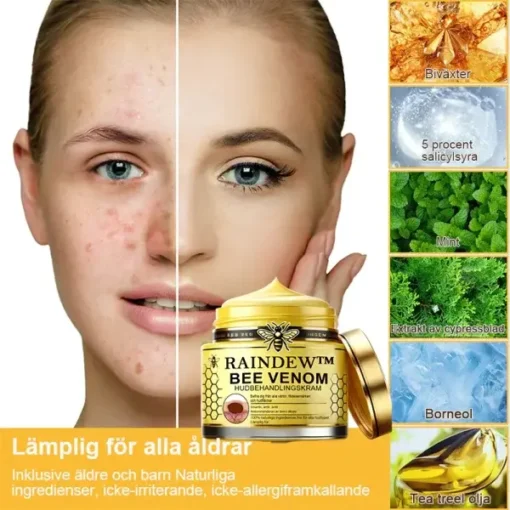 Raindew™ Bee Venom Skin Treatment Cream - Image 8