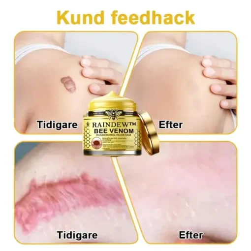 Raindew™ Bee Venom Skin Treatment Cream - Image 9