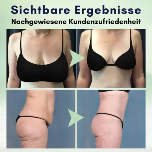 AEXZR™ Erweiterte Straffende Körpercreme - Image 9