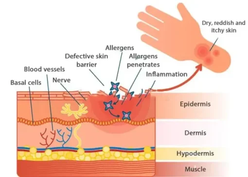 AEXZR™ Folliculitis Clearing Spray - Image 8