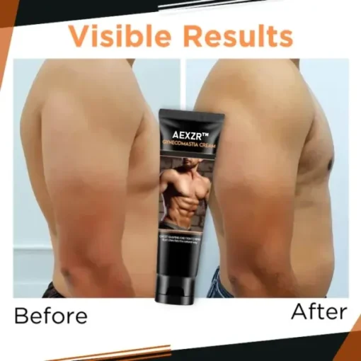 AEXZR™ Gynecomastia Cream - Image 4