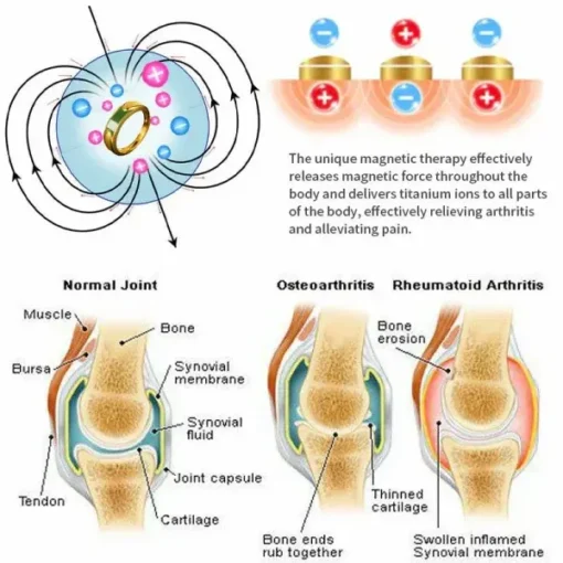 Adjustable opening Lymphatic magnetic therapy ring - Image 7