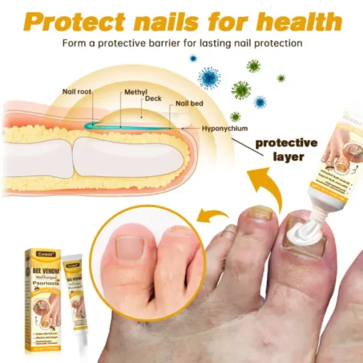 CVREOZ™ Bee Venom Nail Fungus Psoriasis Treatment Cream - Image 4