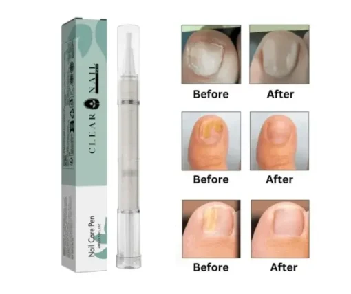 ClearNail Pro™ – Nail Care Pen